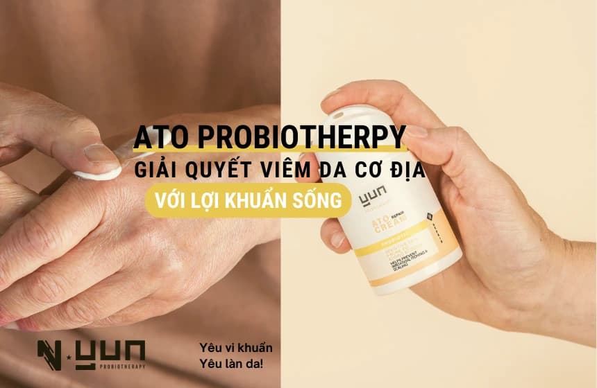 product1